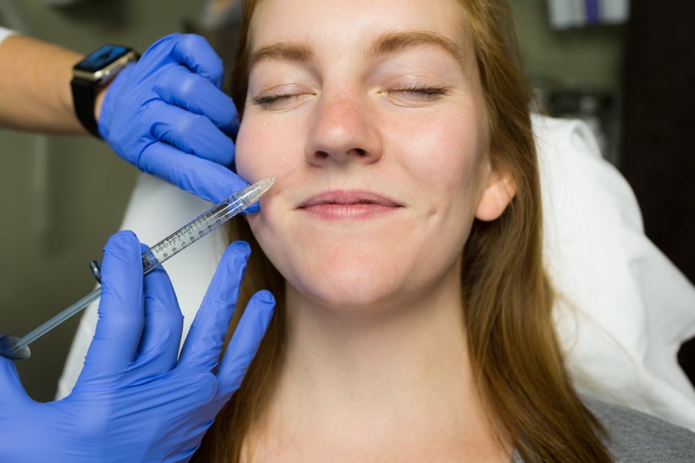 Bruises From Dermal Fillers and Botox Injections