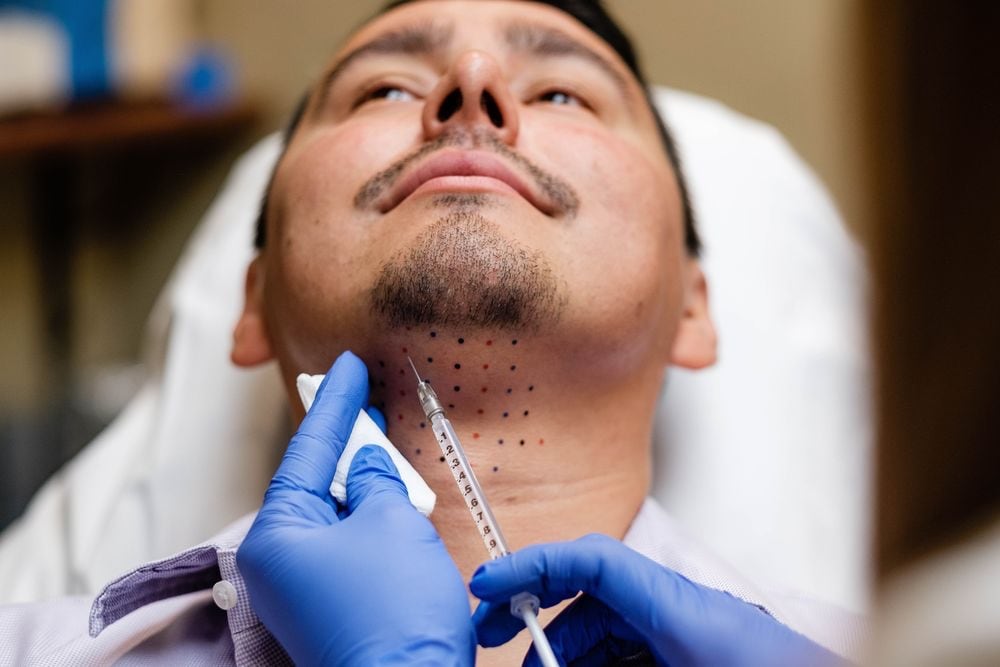 Male Facial Sculpting: Jaw Exerciser Vs. Fillers — The Med Spa