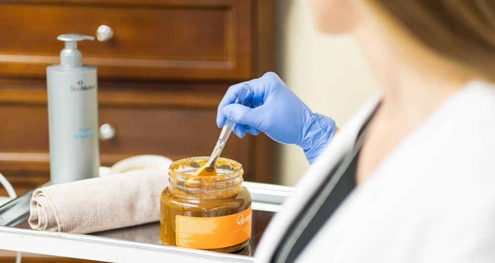 Chemical Peel After Summer in San Diego at Siti Med Spa