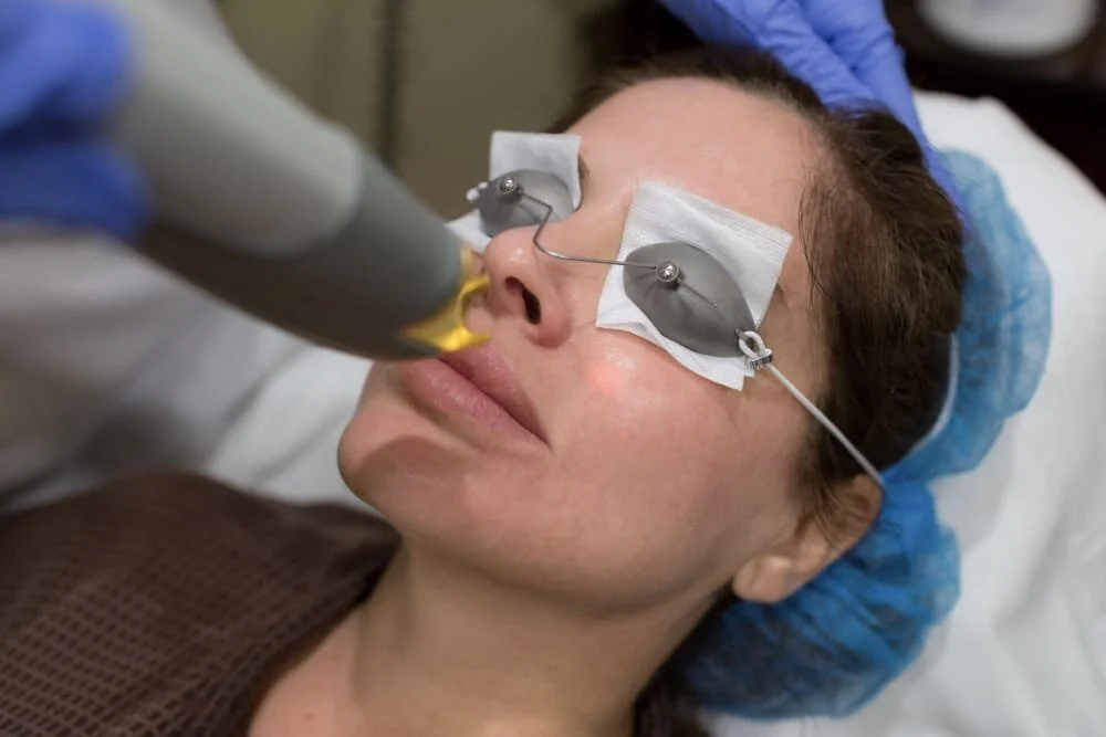 How Long Does It Take To Heal From Laser Resurfacing?