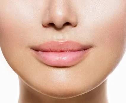 A woman shows the lower half of her face with a focus on her lip fillers.