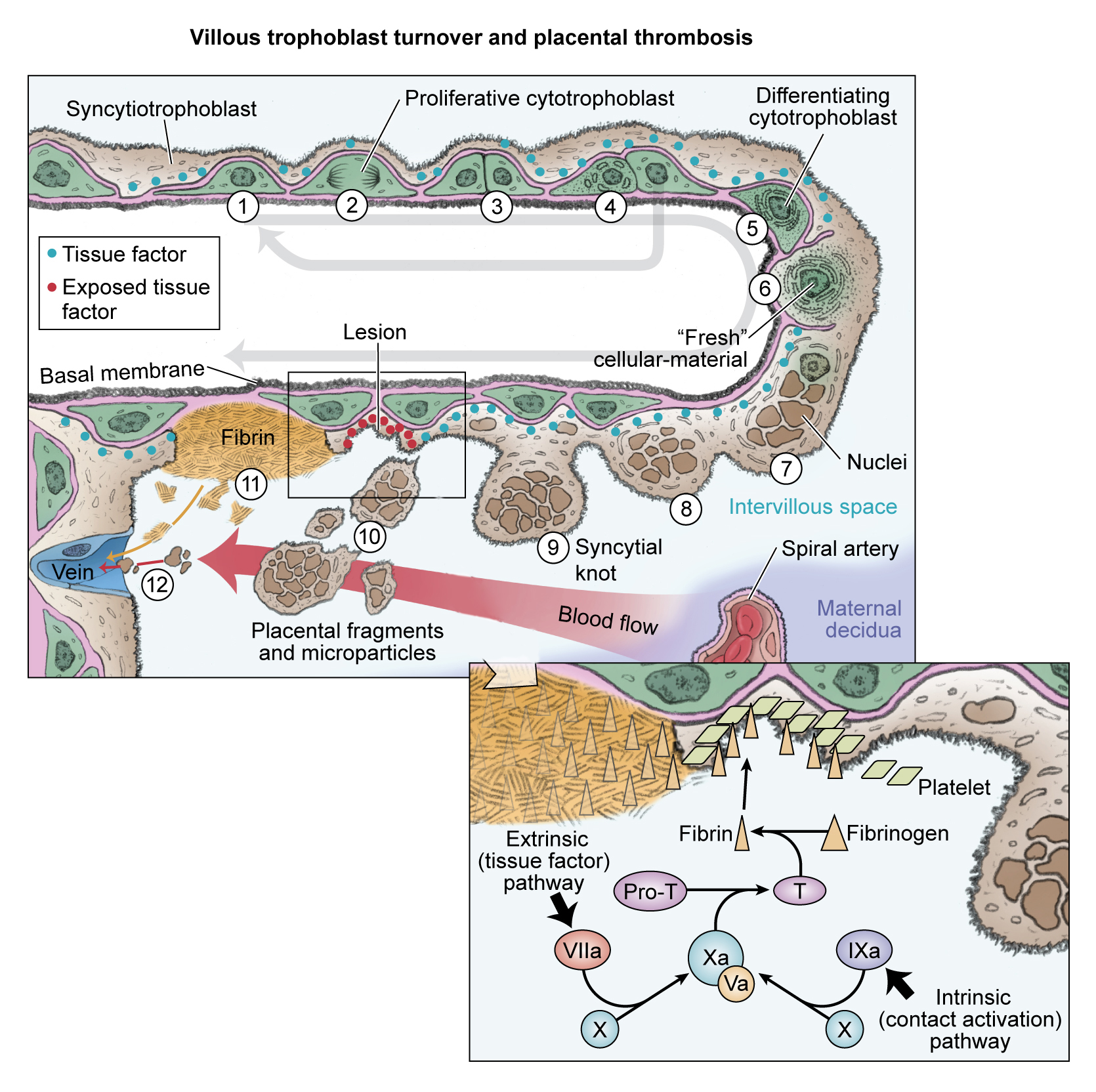 Coagulation on the placental surface 