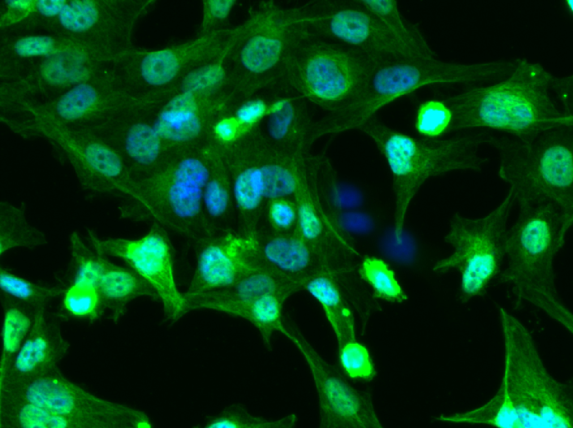 HTR SVNeo extravillous trophoblast - like cell line