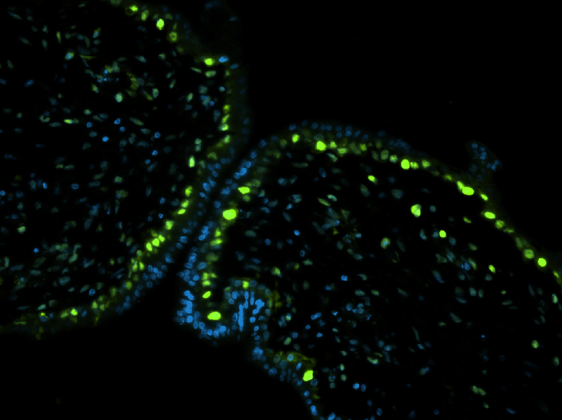 Placental tissue examined for cell division