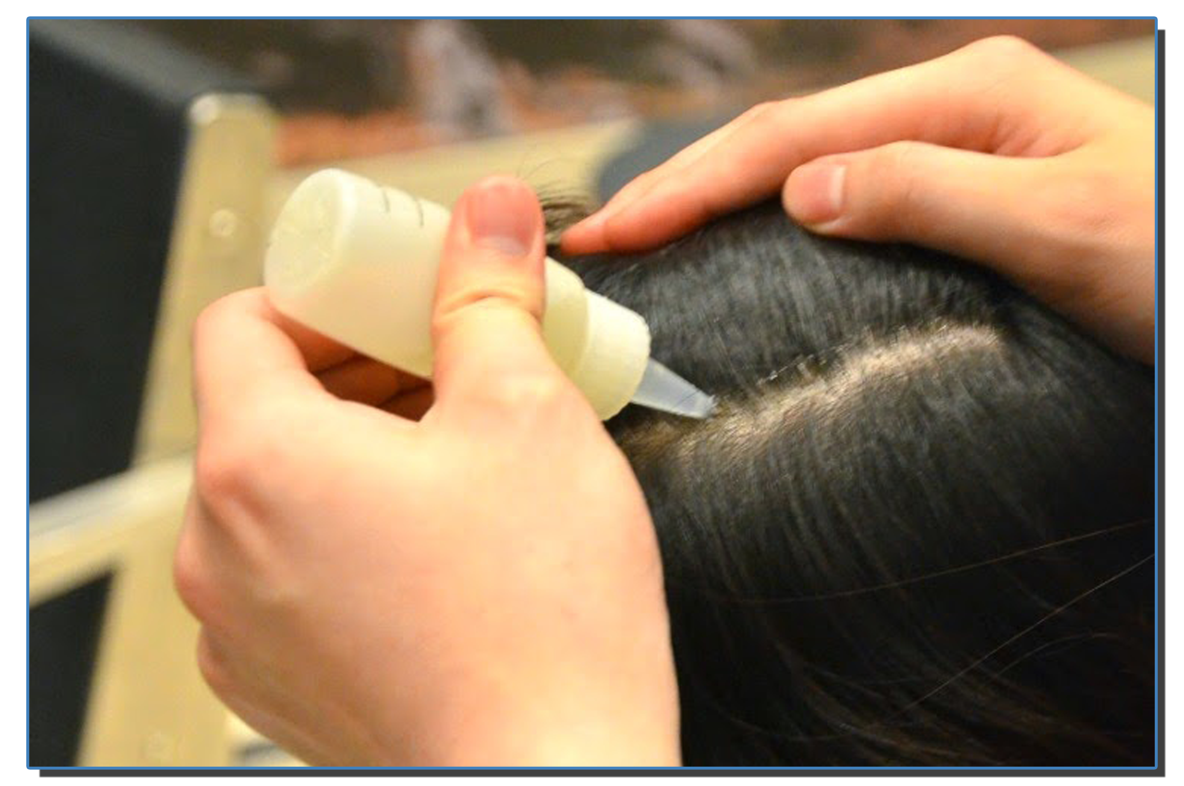 Intense Scalp Conditioning Treatment