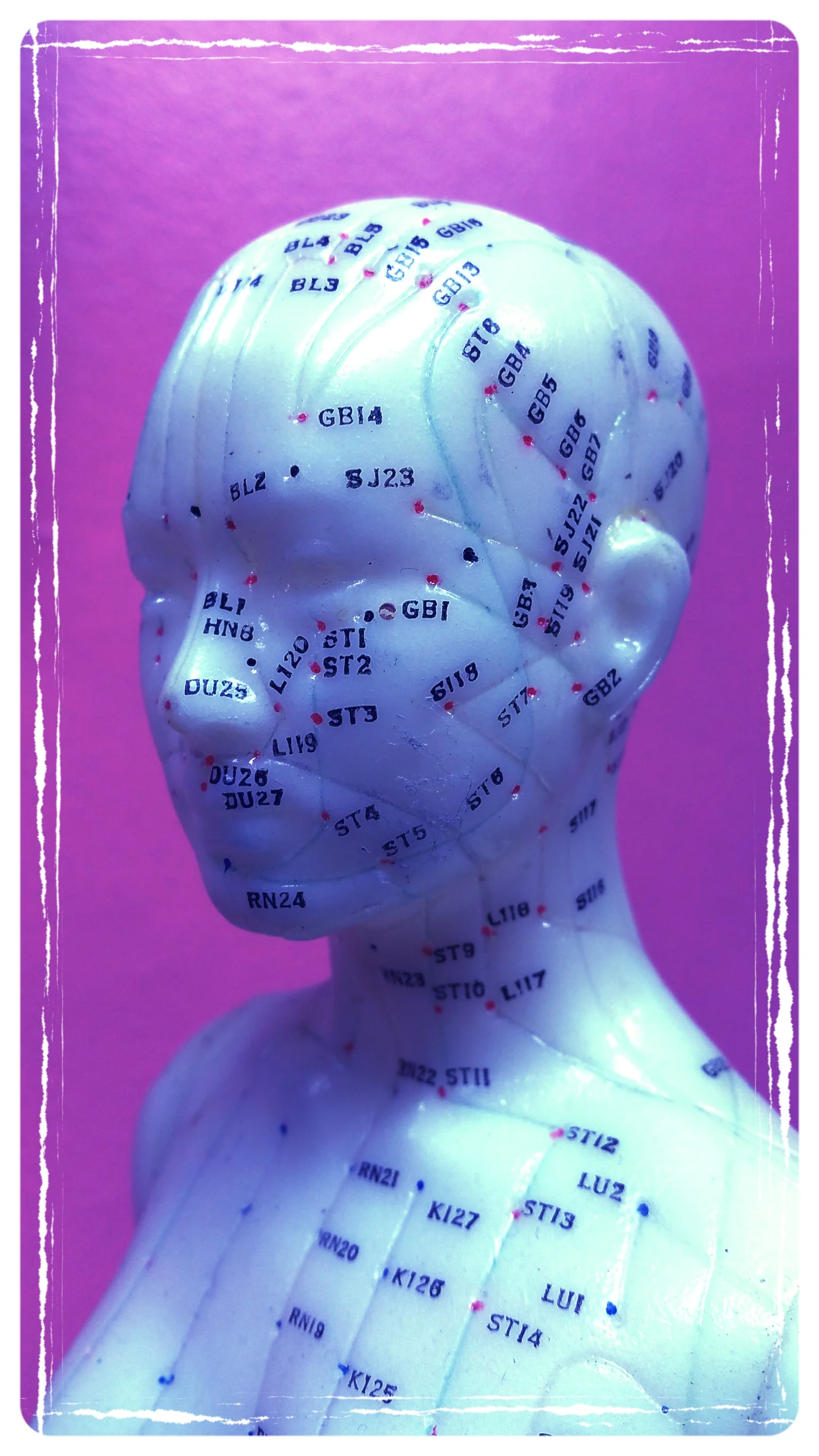 Remee's Acupuncture treatments for Fertility, Richmond, VA