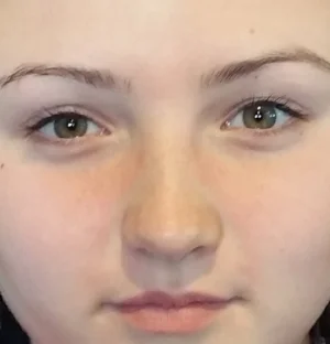 Face Reading can provide accurate health and personality information.