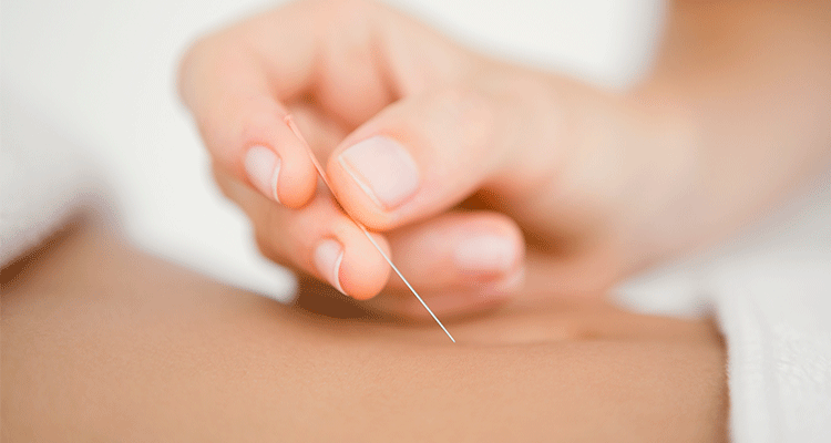 Acupuncture and IVF in Richmond, VA
