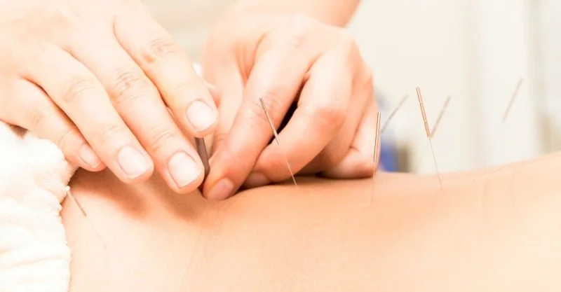 How Acupuncture Increases Chances of Conception