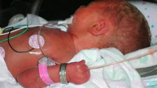 preterm 2.jpg