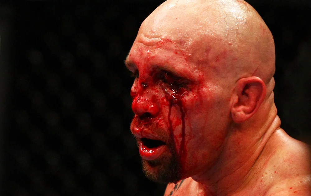 UFC 192 - Skadelisten