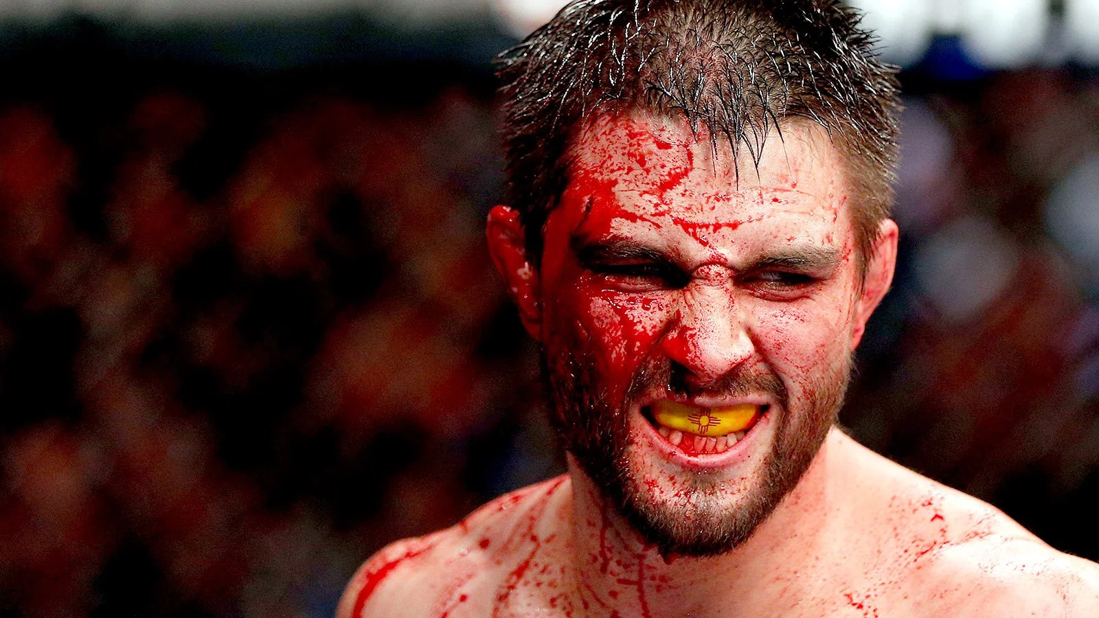 Endelig er Carlos Condit tilbake – Møter Neil Magny ved UFC 219