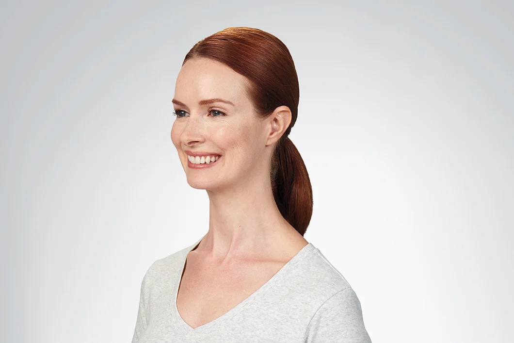 7 days after the botox treatment
