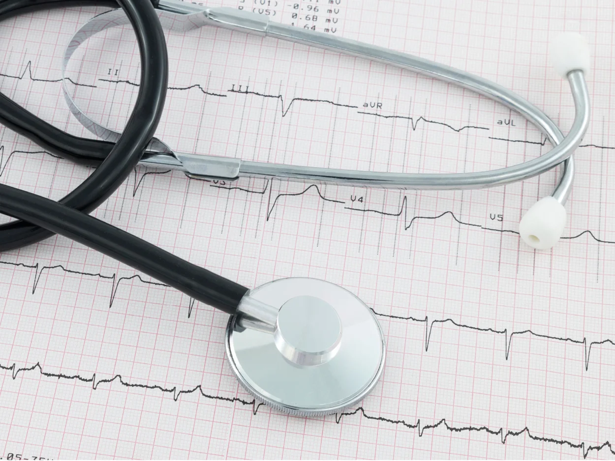 Services_ecg 600x450px copy.jpg