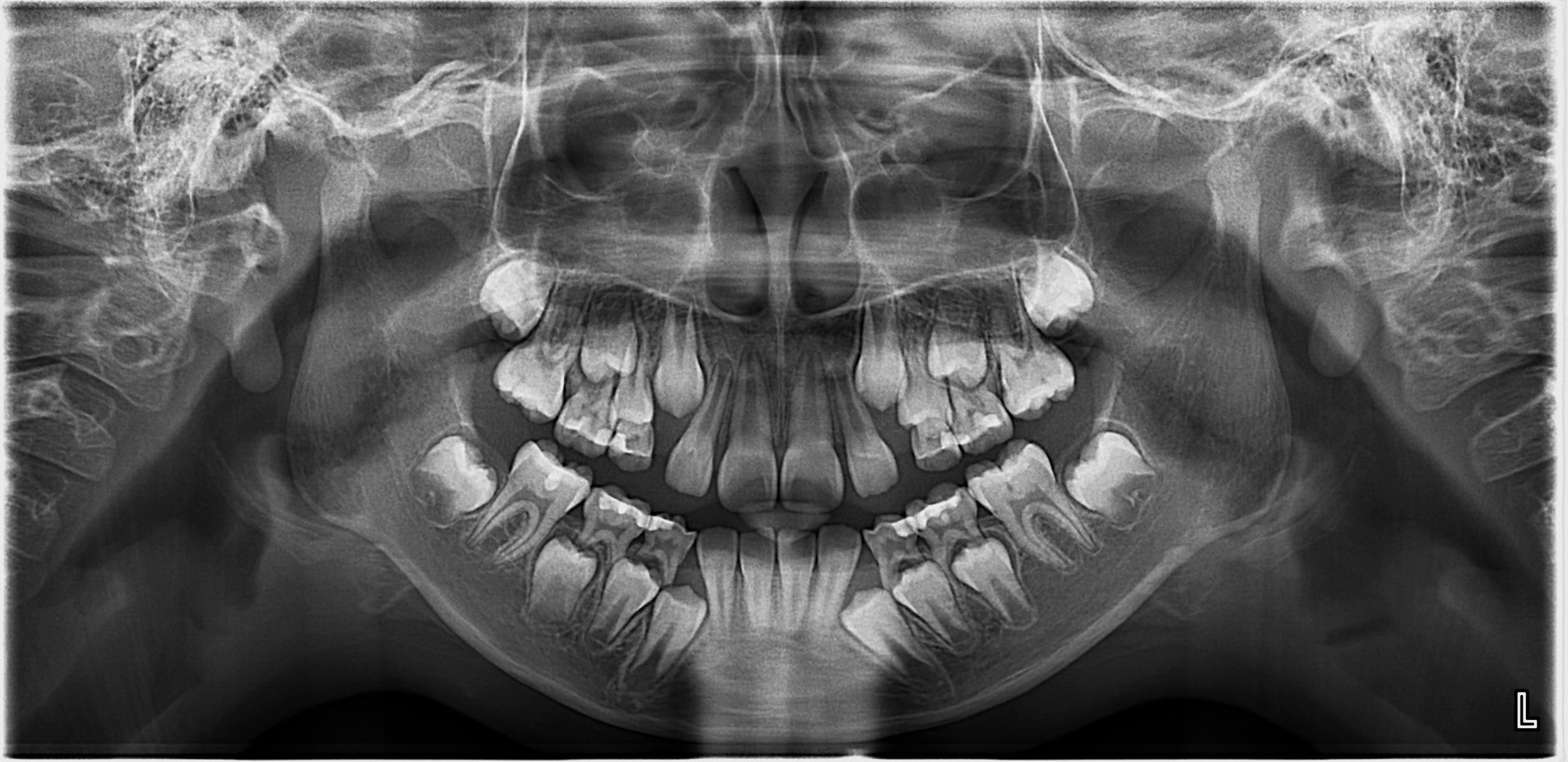 Look at all those teeth!