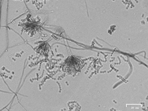 sac fungi.jpg