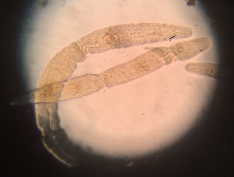 Ciliphora