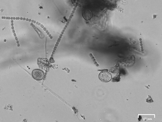 Cyanobacteria chains