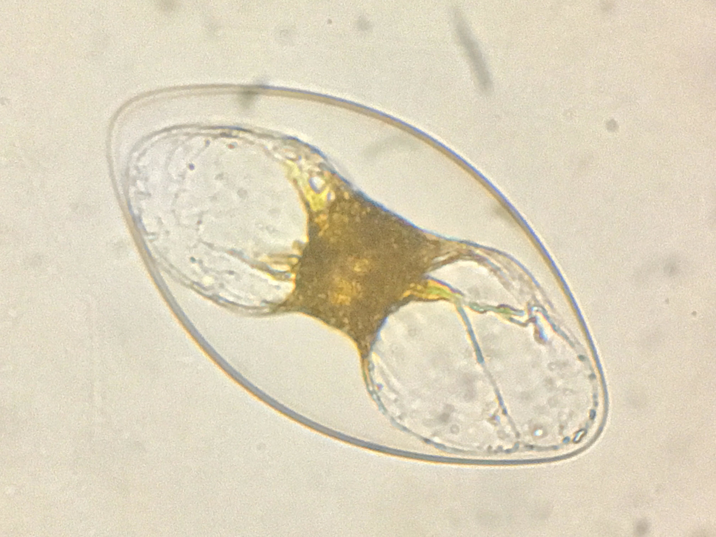 Pyrocystis 400x magnification. Photo by Damon Tighe