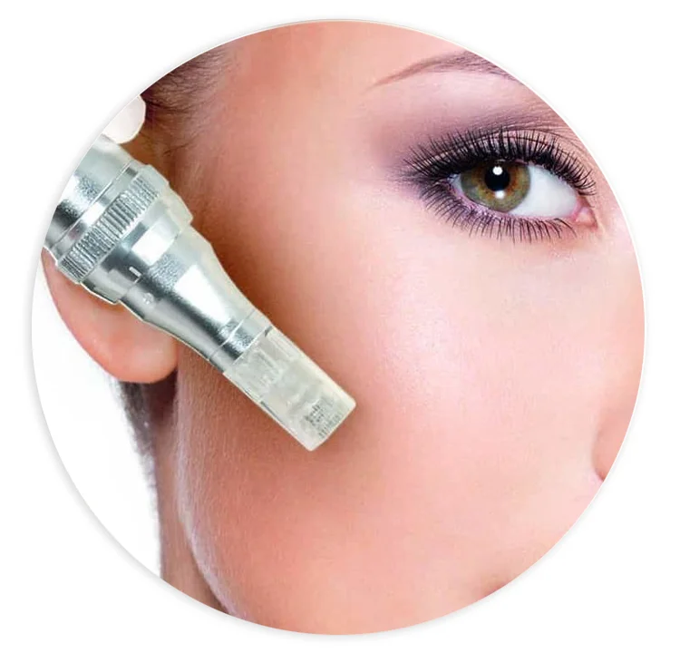 microneedling.jpg