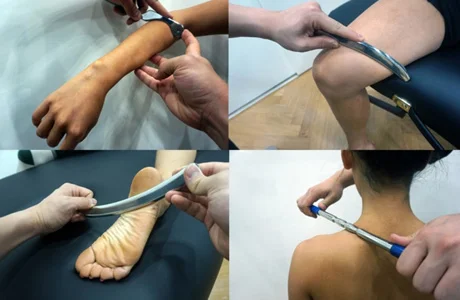 Example of the Graston Technique from