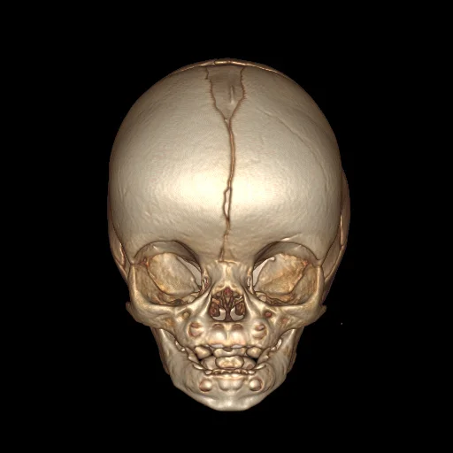 se000.jpg