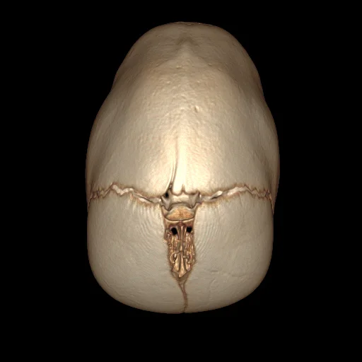 se002.jpg