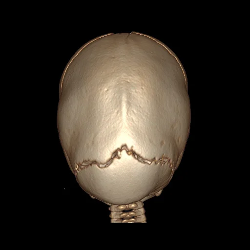 se005.jpg