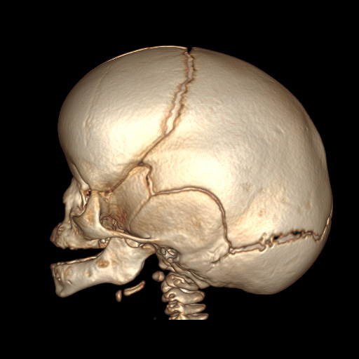se003.jpg