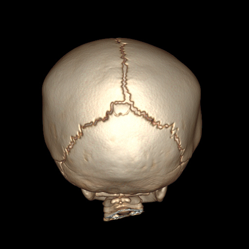 se005.jpg