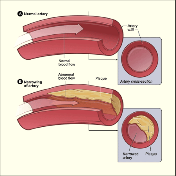 Image courtesy of NHLBI