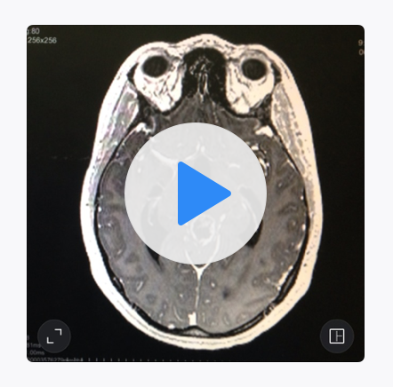 Screen Shot 2017-08-06 at 9.38.36 AM.png