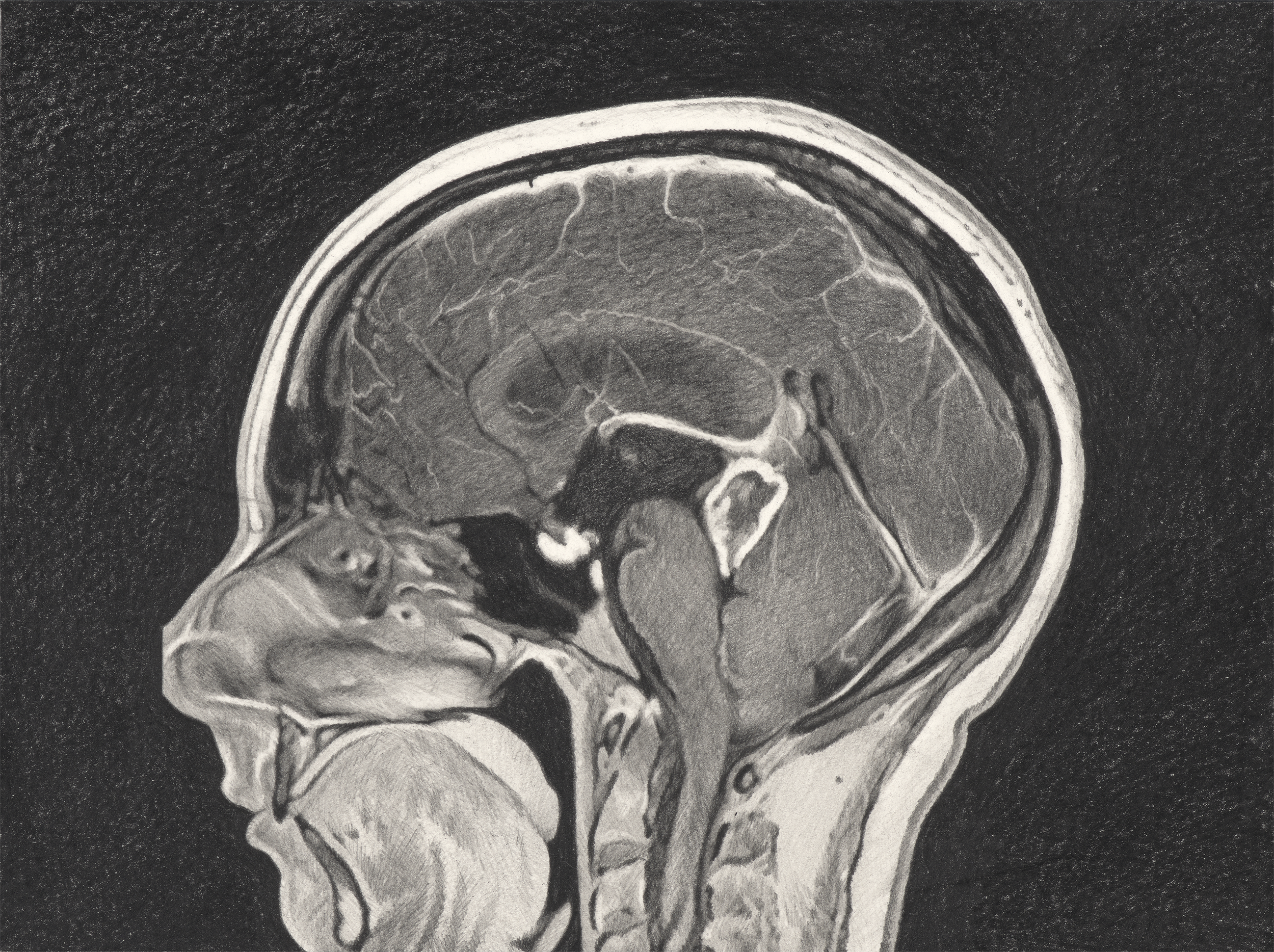   Untitled (MRI 1) , 2025, graphite pencil on paper, 9 × 12” (approximately life size) 