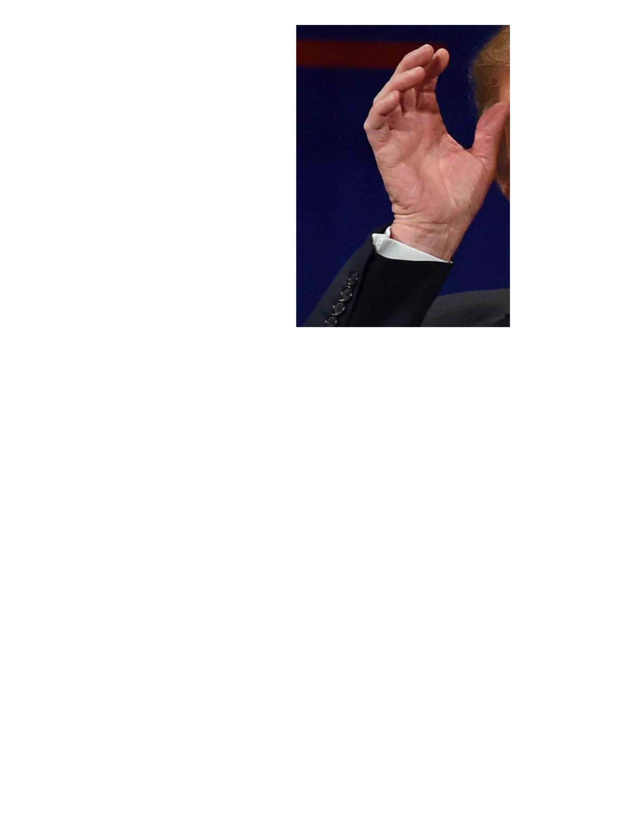 Trump_Hands_004HHB-2.jpg