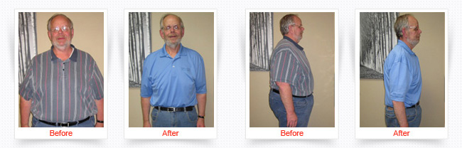 ChiroThin Weight Loss Progress Photos Front and Side Before And After Of Older Male Patient In Light Blue Shirt