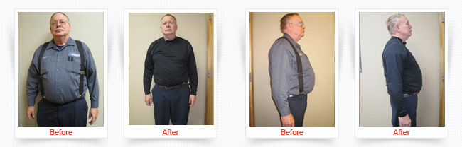 ChiroThin Weight Loss Progress Photos Front and Side Before And After Of Older Male Patient in Black And Gray Shirt