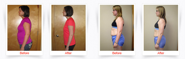 ChiroThin Weight Loss Progress Photos Front and Side Before And After Of Young Female Patient in Red Shirt