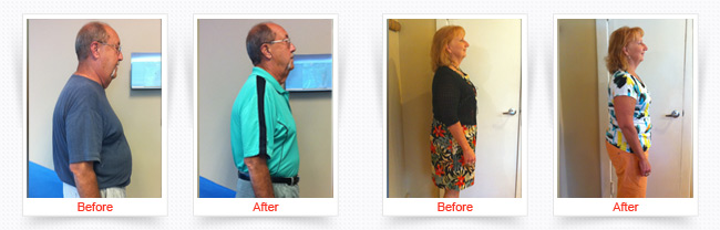 ChiroThin Weight Loss Progress Photos Front and Side Before And After Of Both Man And Woman Patients