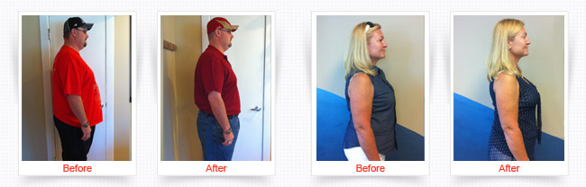 ChiroThin Weight Loss Progress Photos Front and Side Before And After Of Male And Female Patients