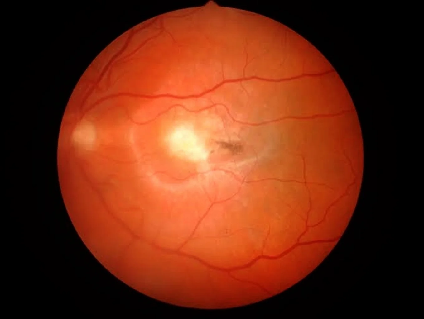 Dr. David Bloomberg, O.D. — POWAY EYE CENTER