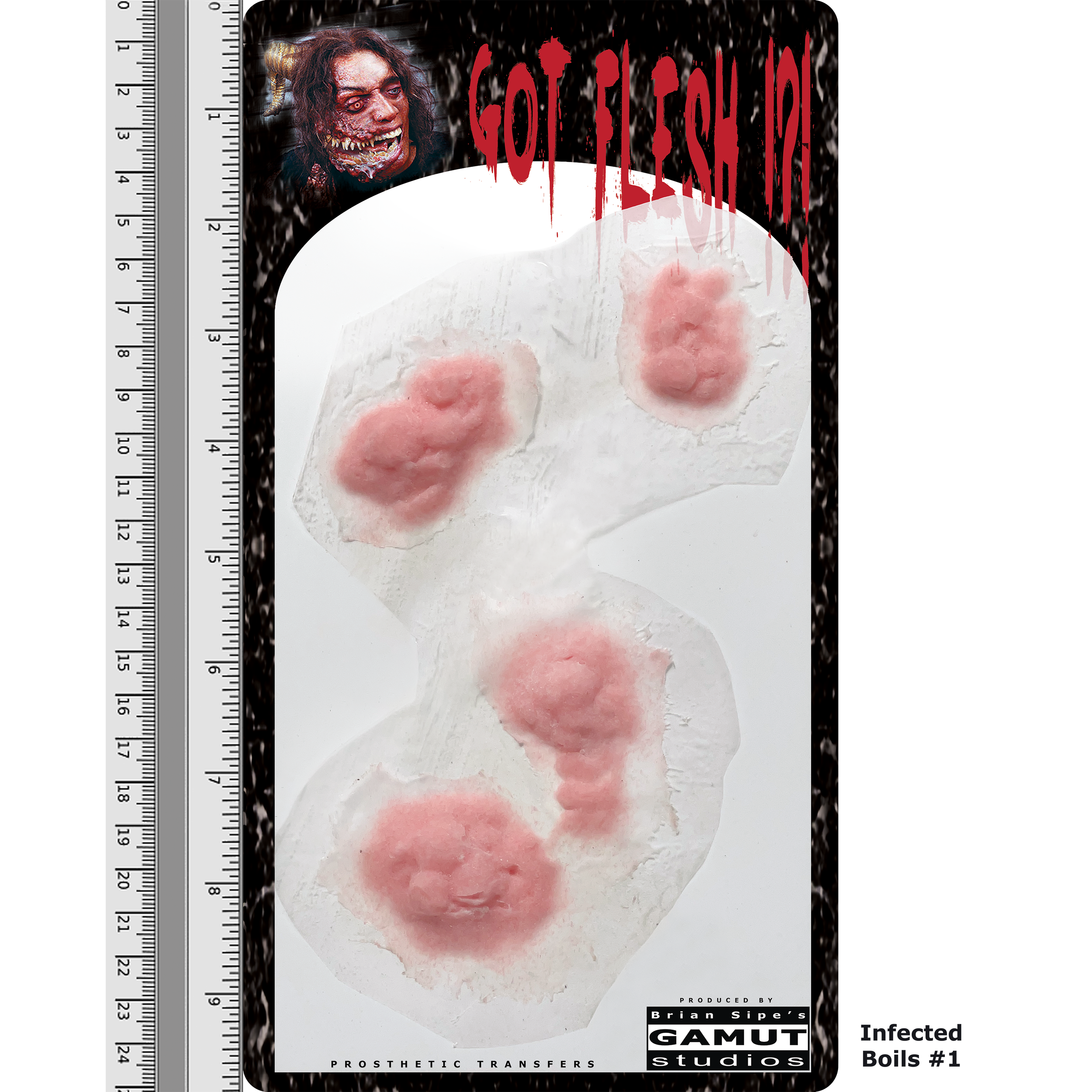 GFCR022 - Infected Boils 1  - 2.9.2025 - DDL03.png