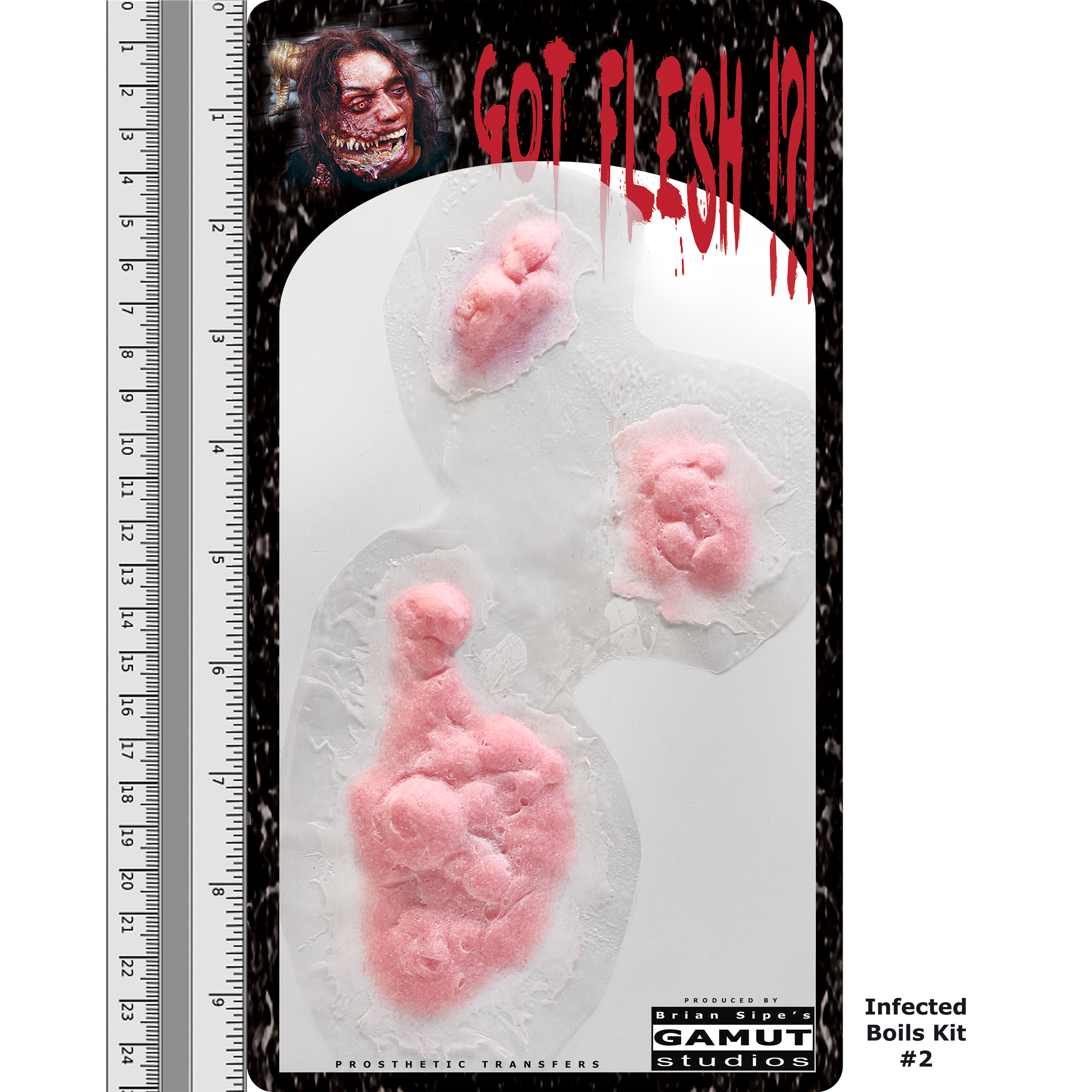 GFCR023 - Infected Boils 2  - 2.9.2025 - DDL03.png