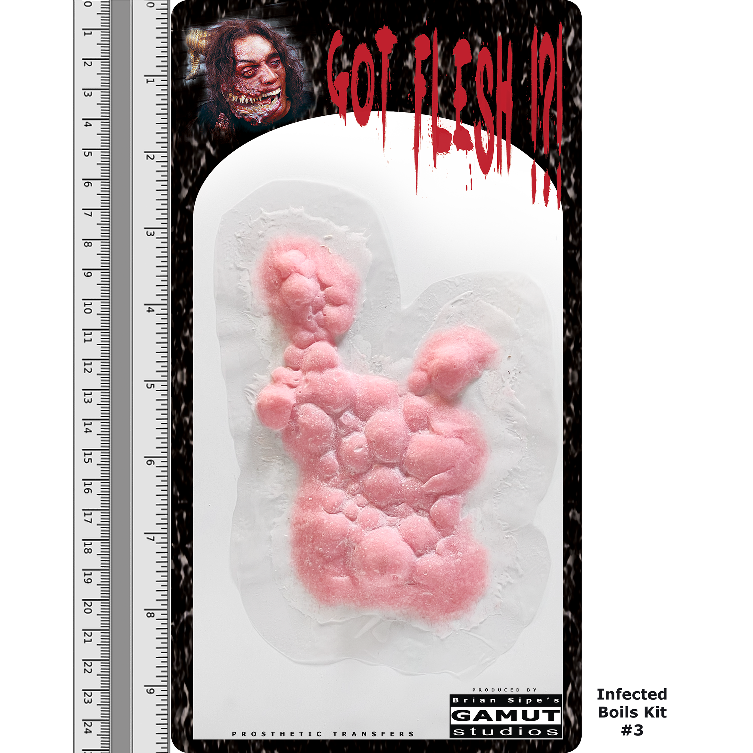 GFCR024 - Infected Boils 3  - 2.9.2025 - DDL03.png