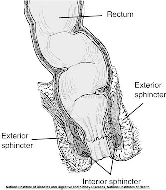 Anal pain after ejaculation