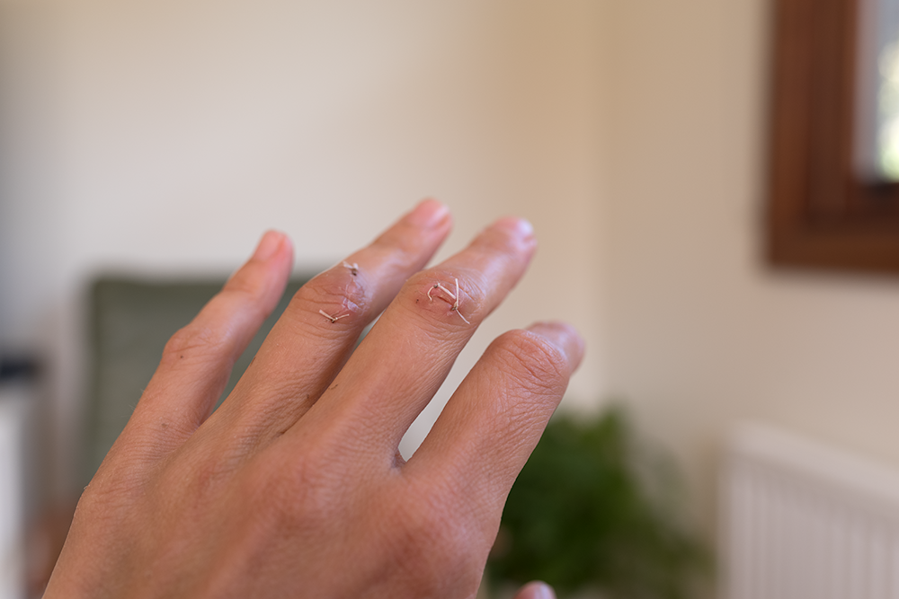 And more stitches, just before they came out.