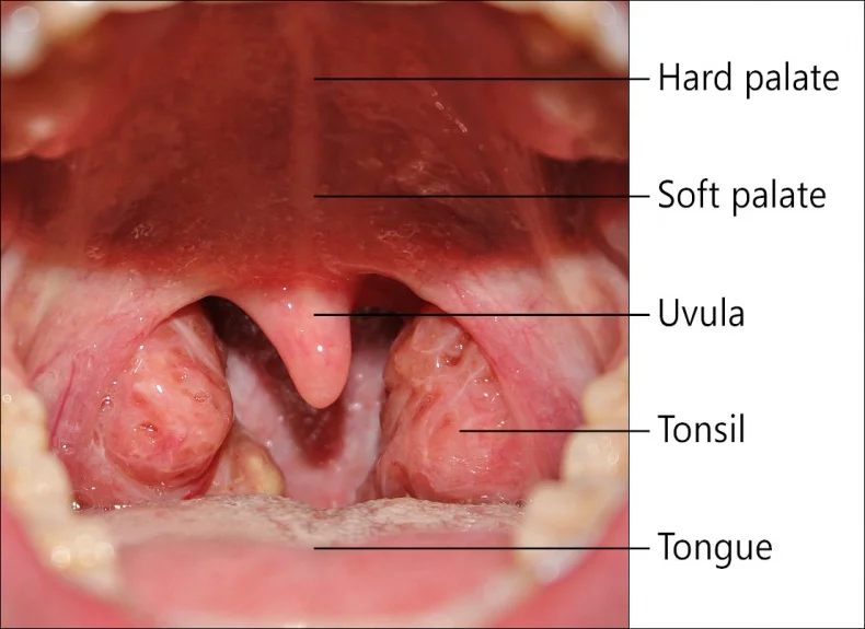 throat.jpg