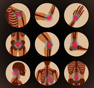 The Life and Death of Inflammation