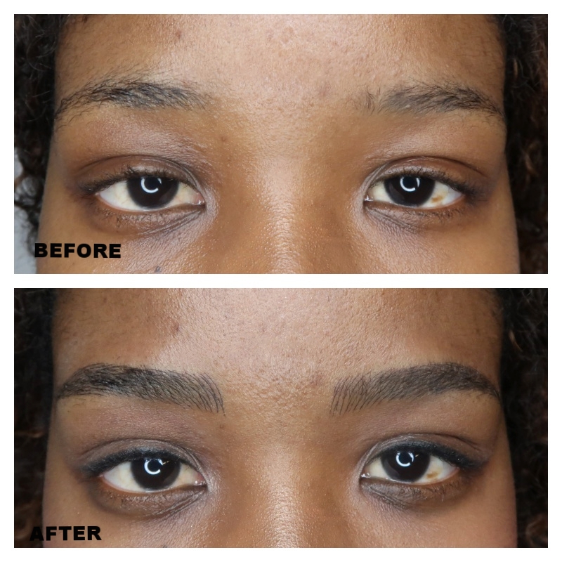 EYEBROW ENHANCEMENT