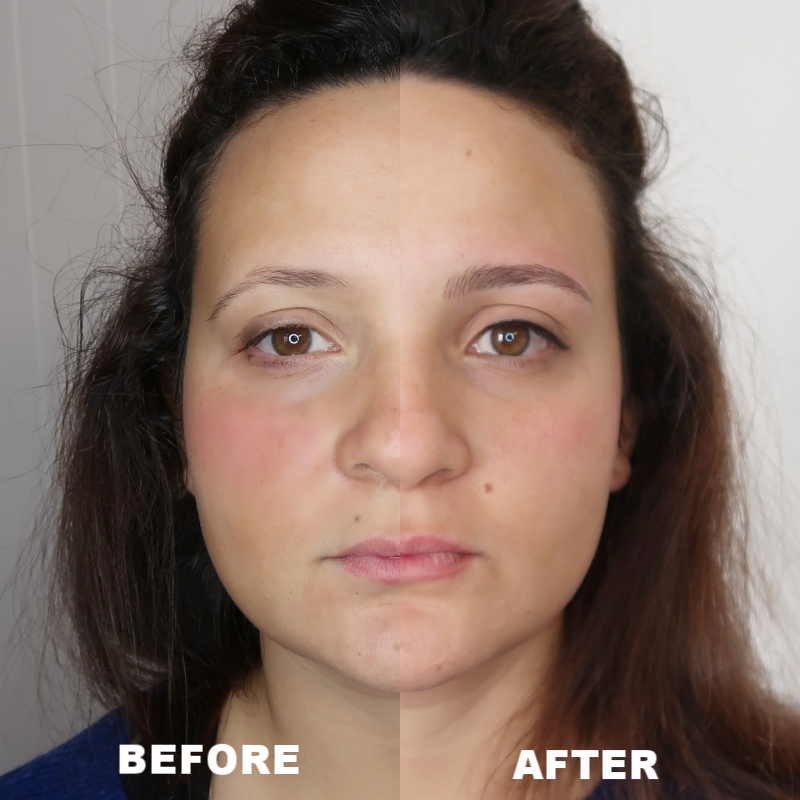 EYEBROW ENHANCEMENT BEFORE&AFTER