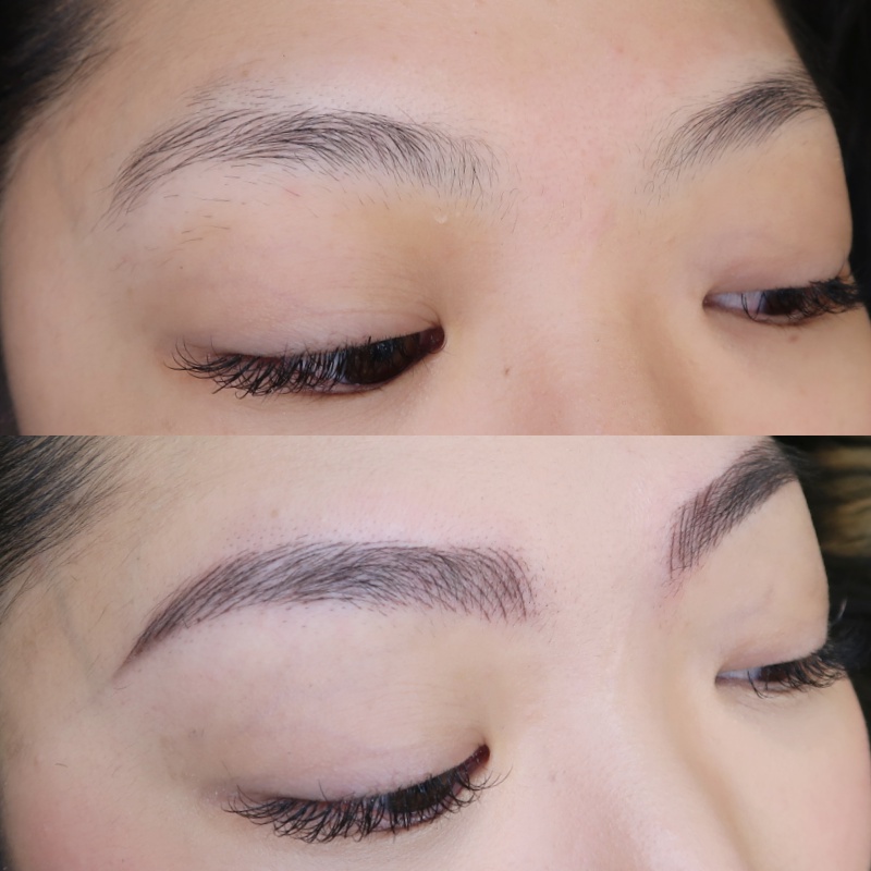 brow